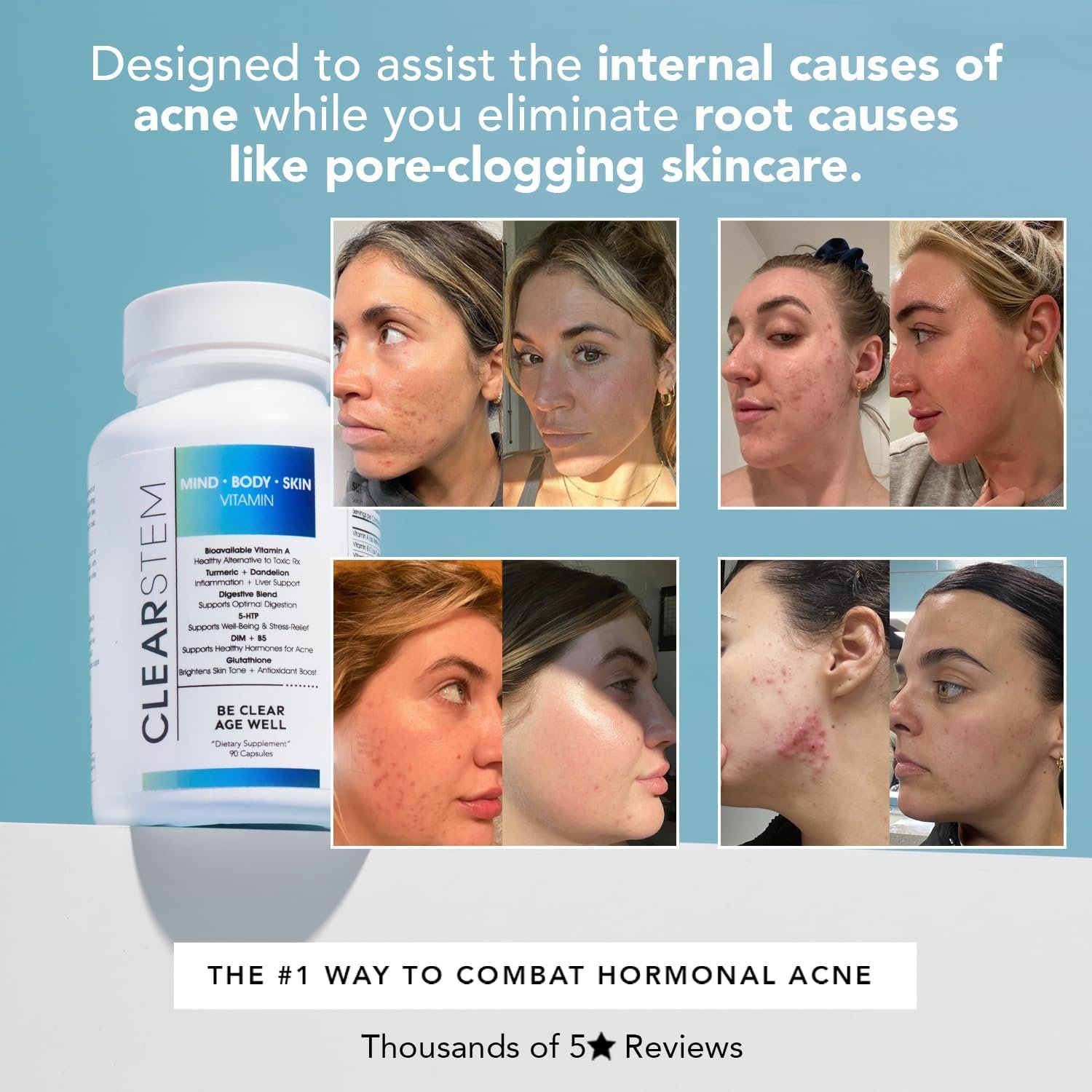 CLEARSTEM - MINDBODYSKIN Hormonal Acne Supplement (5-HTP) - Natural DIM Supplement - Skin Care Vitamins - Hormone Balance, Antioxidants - Vegan, Gluten Free, Cruelty Free - 30 Servings, 90 Capsules