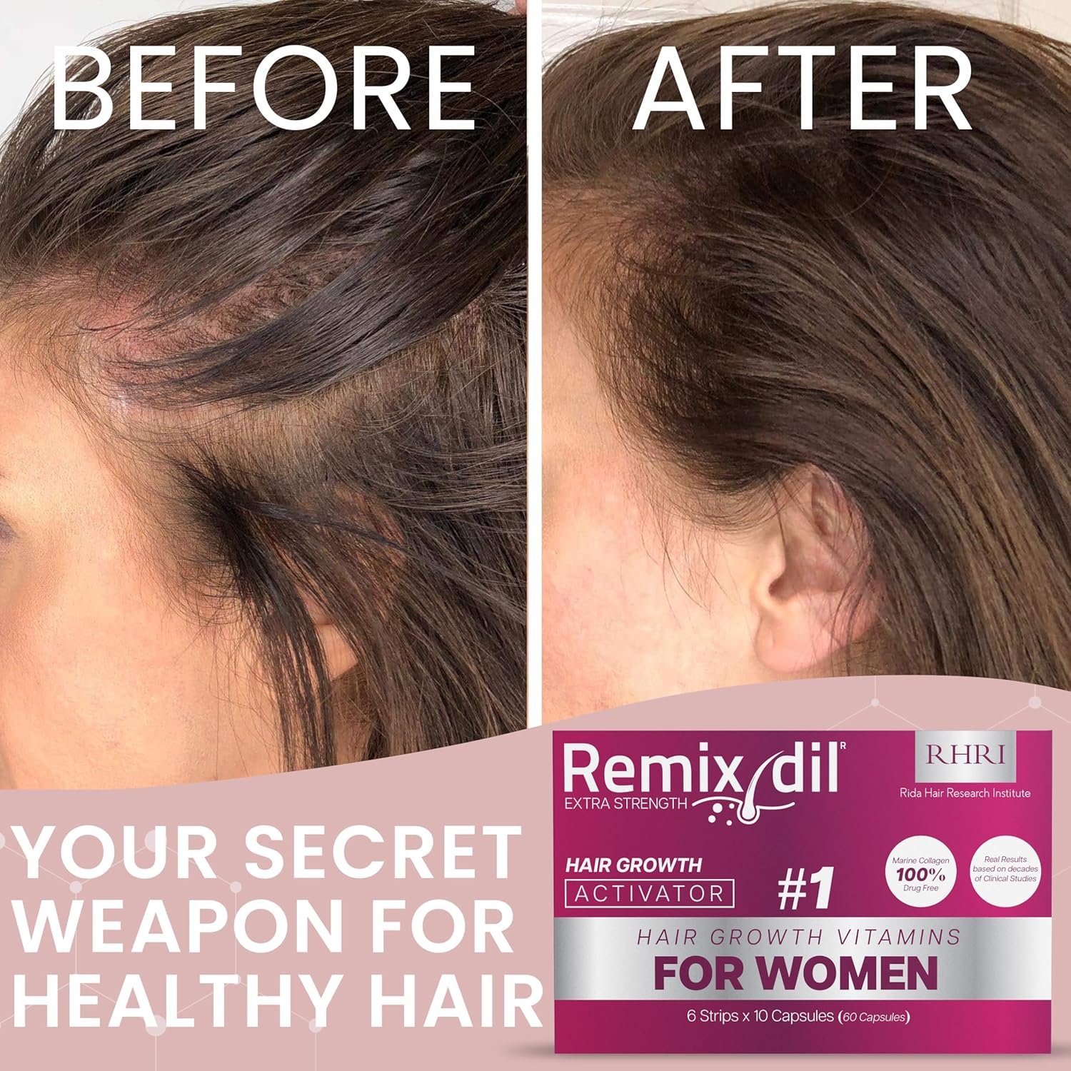 Hair Growth Vitamins for Visibly Thicker Stronger Hair - Supplements for Hair Loss Treatment and Thinning Hair in Women