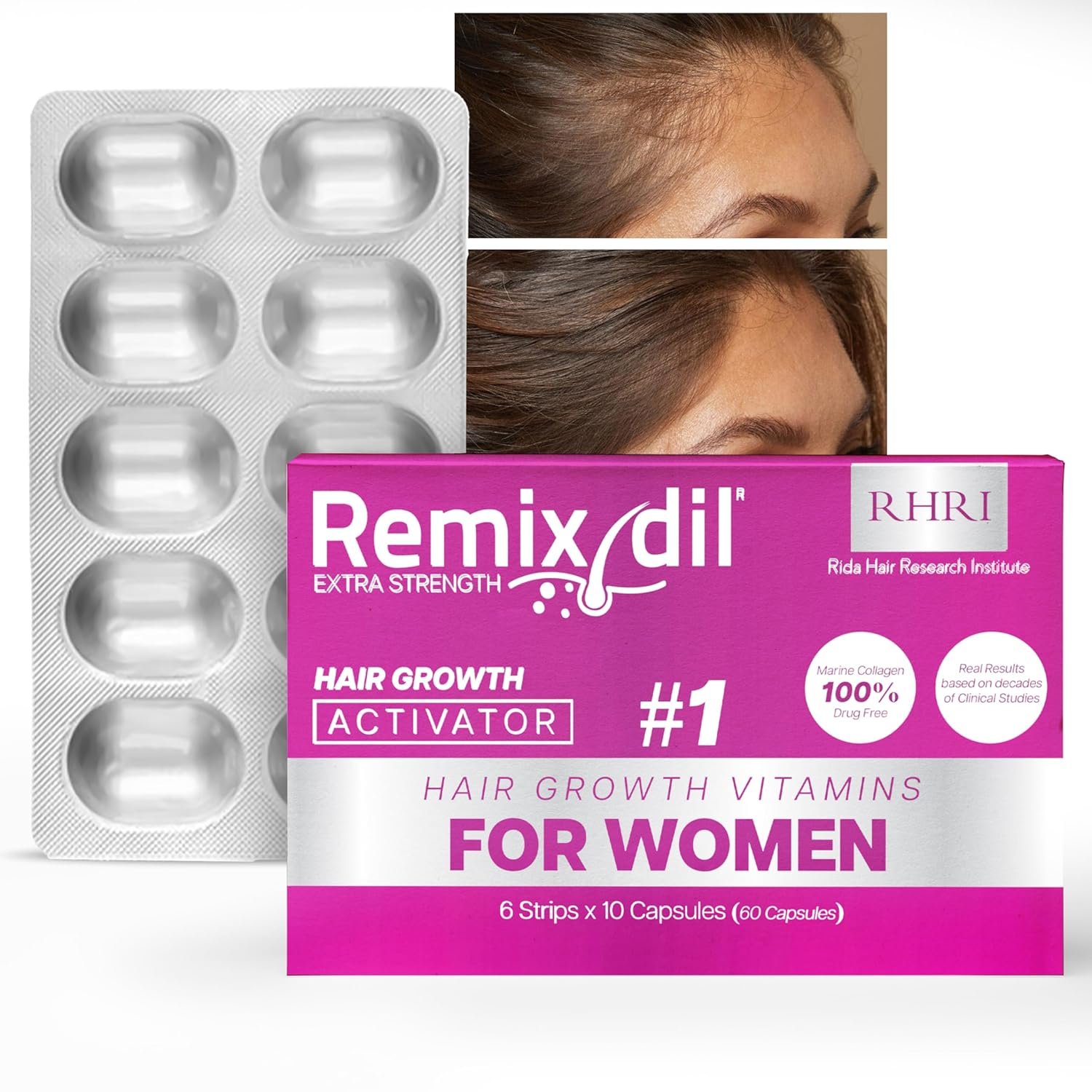 Hair Growth Vitamins for Visibly Thicker Stronger Hair - Supplements for Hair Loss Treatment and Thinning Hair in Women