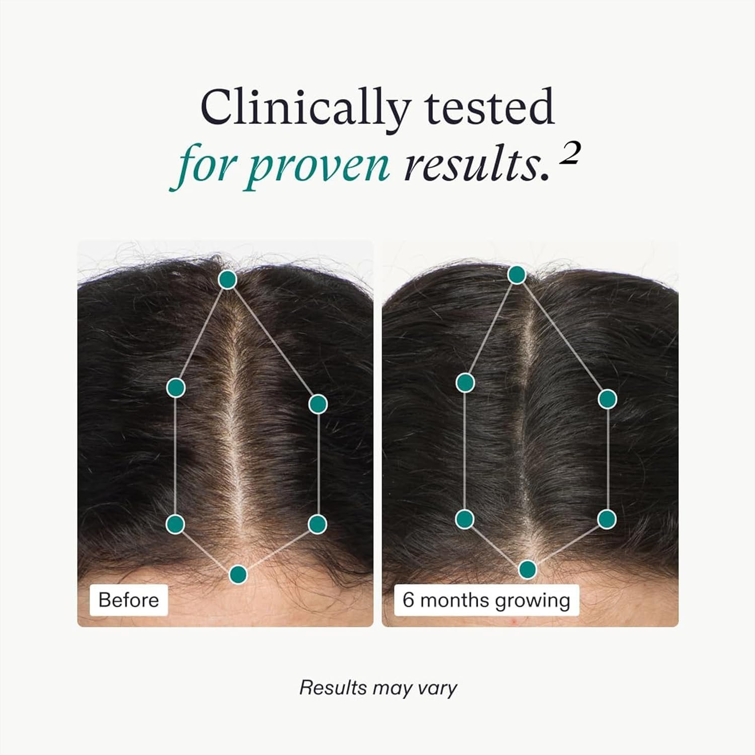 Nutrafol Womens Hair Growth Supplements, Ages 18-44, Clinically Proven for Visibly Thicker and Stronger Hair, Dermatologist Recommended - 1 Month Supply