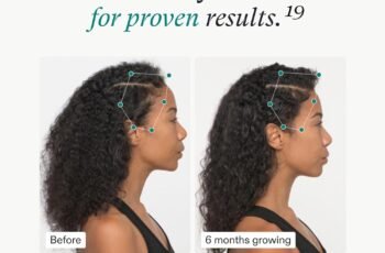 Nutrafol for Women 18-44 Review