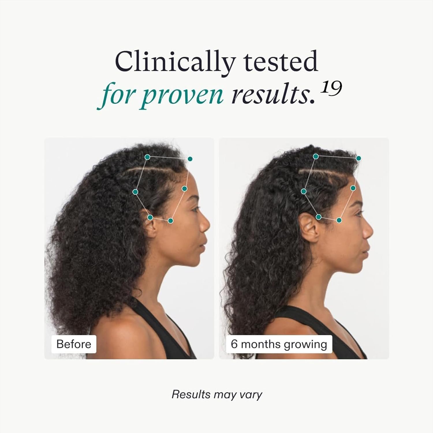Nutrafol Womens Hair Growth Supplements, For Women 18-44 Years Old, Clinically Tested for Visibly Thicker, Stronger Hair, 100% Vegan Ingredients, Dermatologist Recommended - 1 Month Supply